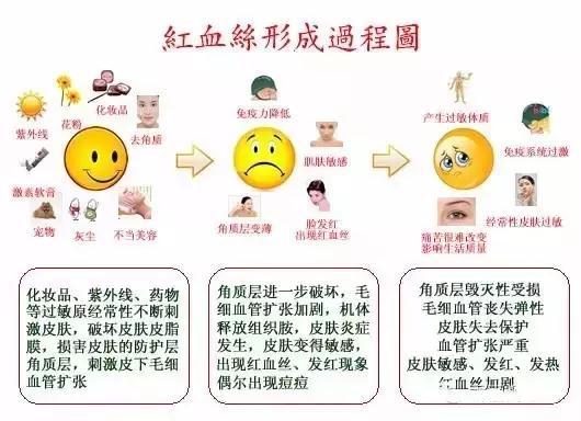 血丝多了怎么办,红血丝一直不退怎么办