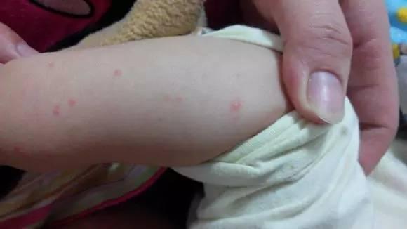 小孩越来越怕冷怎么回事,孩子怕冷是不是要发高烧前兆