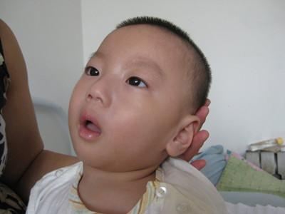 脑瘫属不属于智力残疾,脑瘫属不属于慢性病