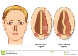 天生就歪头的人有什么说法,天生歪鼻梁的人