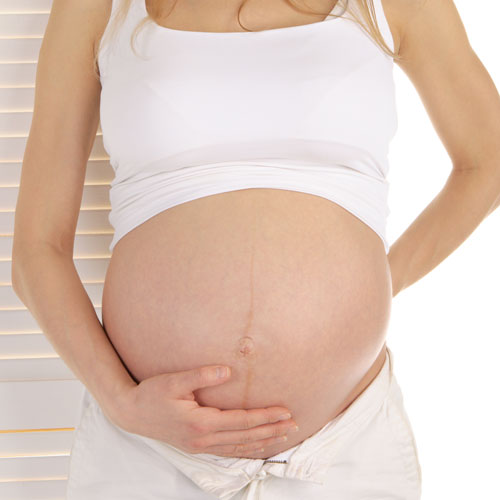 生孩子羊水栓塞百分之90的死亡率,羊水栓塞的死亡率高达