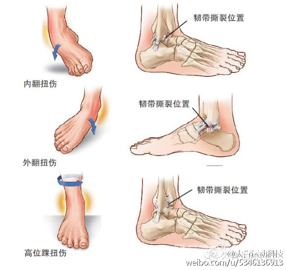 希望所有打篮球的男孩都远离伤病,每个爱打篮球的人都可以远离伤病