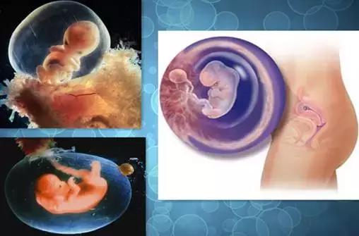 早孕怎么缓解胃难受,如何缓解早孕反应呢