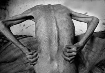 感染艾滋病病毒后会有什么症状,艾滋病病毒如何杀灭