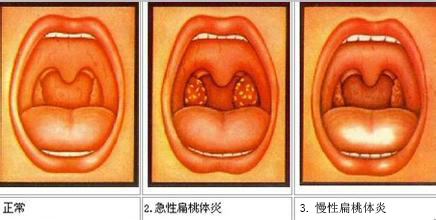 宝贝睡觉打呼噜宝妈要关注了,推拿小儿打呼噜
