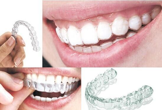 什么样的牙齿矫正需要拔牙,15岁女生牙齿矫正要拔牙吗