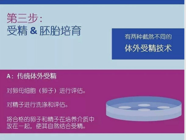 试管婴儿的正确方法及其流程,试管婴儿五种方法