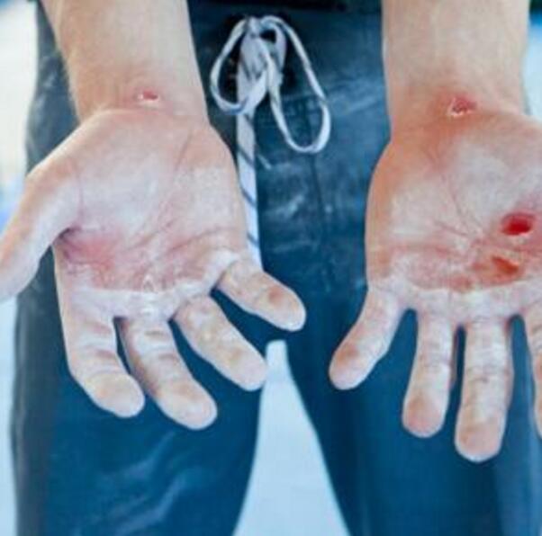 儿子手疼烫伤哭了,儿子手受伤了妈妈心情