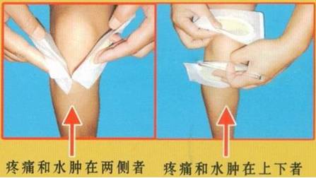 「健康」“冬季模式”已启动，您的老寒腿还好吗？