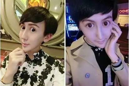 蛇精男刘梓晨原来长什么样,蛇精脸刘梓晨去哪儿了