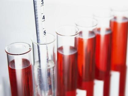 尿液发红是咋回事？发现血尿怎么办？