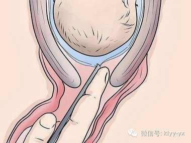 「孕期检查」羊水背后隐藏的秘密，孕妈妈们看后都惊到了！