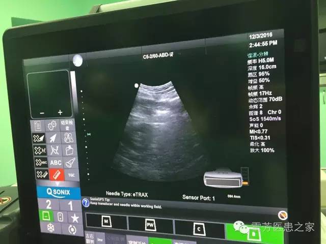 长治市人民医院引进一项不开刀、创面小、术后恢复快的肿瘤治疗“热技术”!