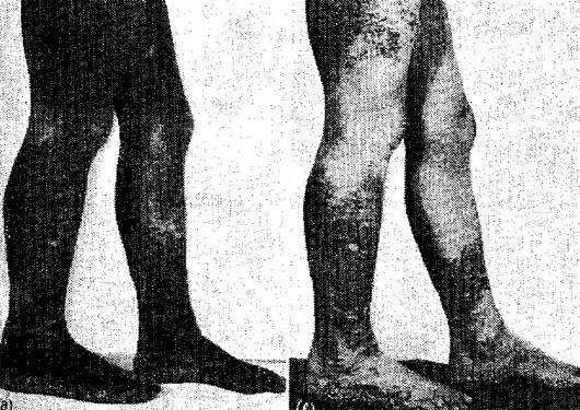 科学严谨的催眠术,神经催眠术