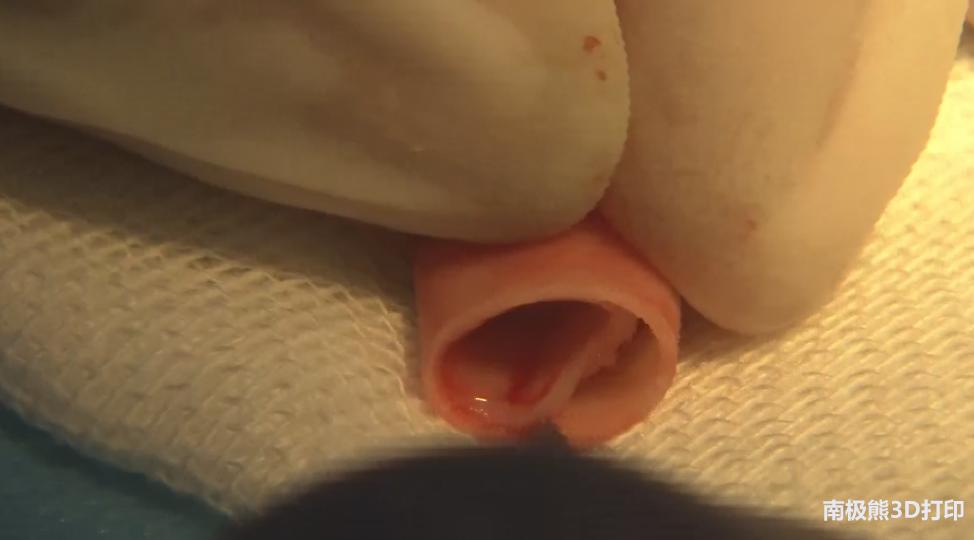 牛叉了！CCTV2《央视财经报道》蓝光英诺3D打印血管植入猴子体内