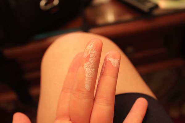 如何去除皮肤、地板和衣服上的强力胶？