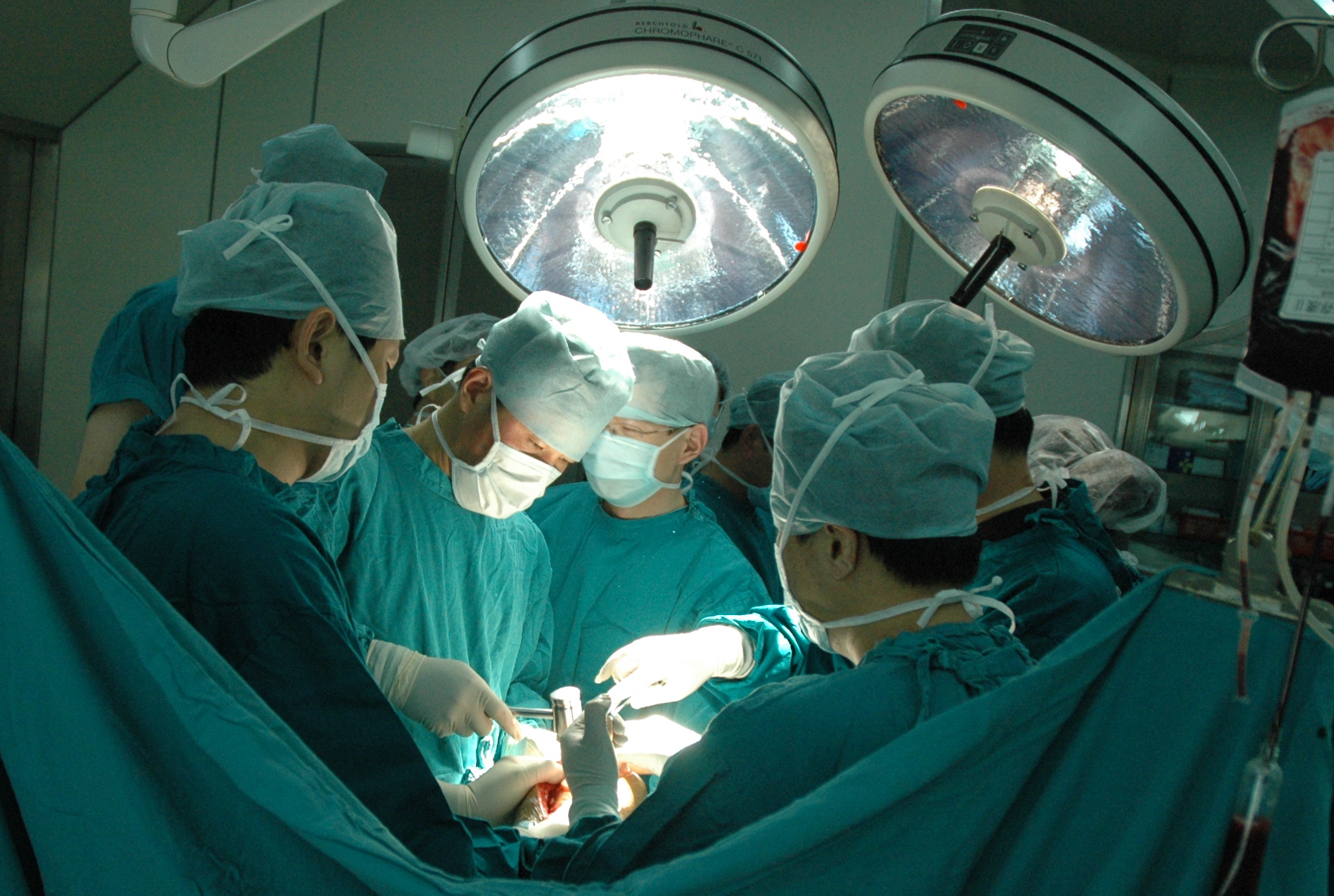 梁医生关于肾结石治疗方法,艾灸治疗肾结石最好方法