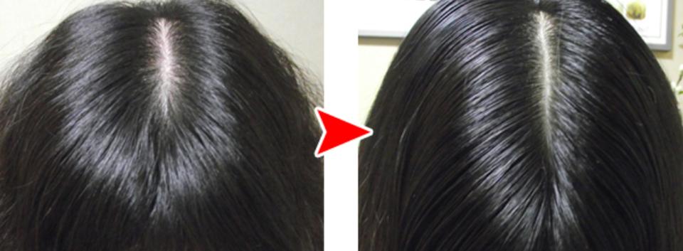 头皮痒怎么办最快最有效的方法,头皮痒什么原因怎么解决