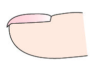 指甲出现白点、纵纹是怎么回事？