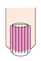 指甲出现白点、纵纹是怎么回事？