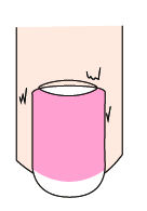 指甲出现白点、纵纹是怎么回事？