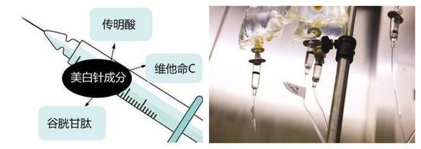 打美白针要知道哪些常识,打美白针要关注这些事项