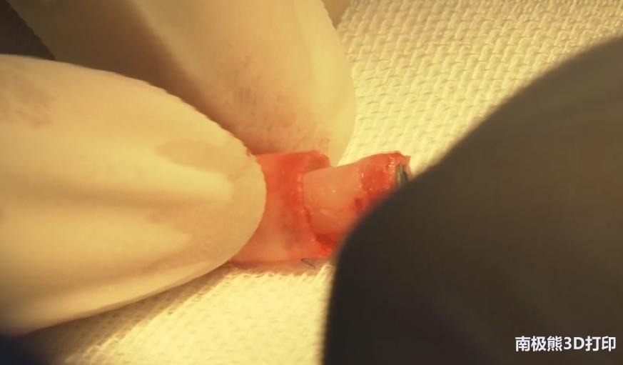 牛叉了！CCTV2《央视财经报道》蓝光英诺3D打印血管植入猴子体内