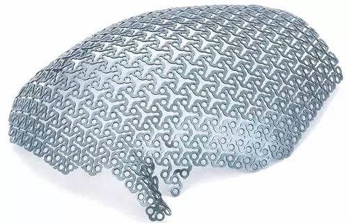 北医三院首例3d打印脊柱怎样了,3d打印助力攻克骨科难题