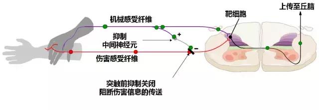 聚焦颈肩腰腿疼,中度疼痛的镇痛方法
