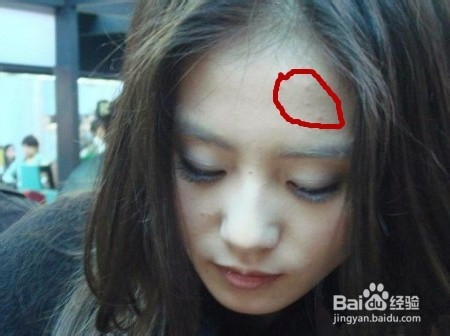 怎样消除青春痘和粉刺最快的方式,如何有效祛除青春痘