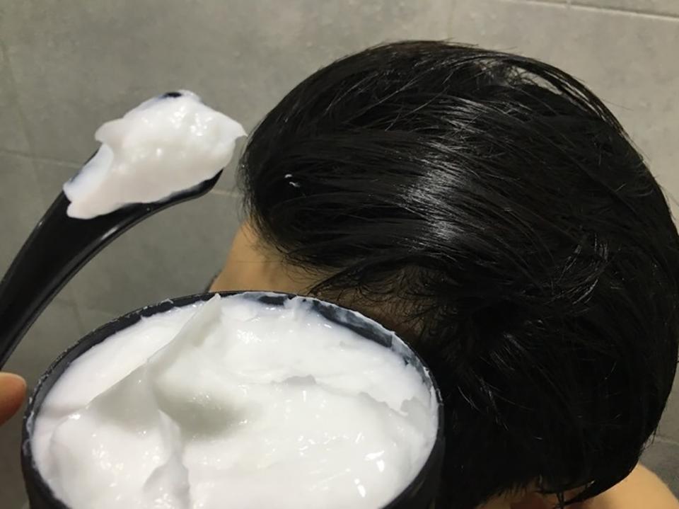 头皮痒怎么办最快最有效的方法,头皮痒什么原因怎么解决