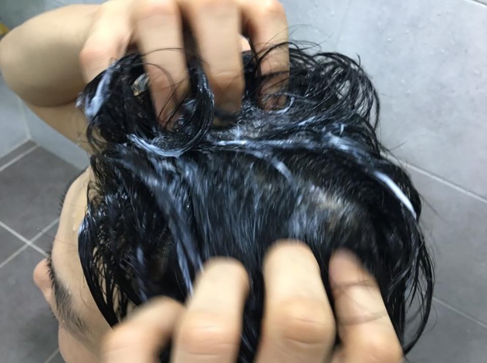 头皮痒怎么办最快最有效的方法,头皮痒什么原因怎么解决