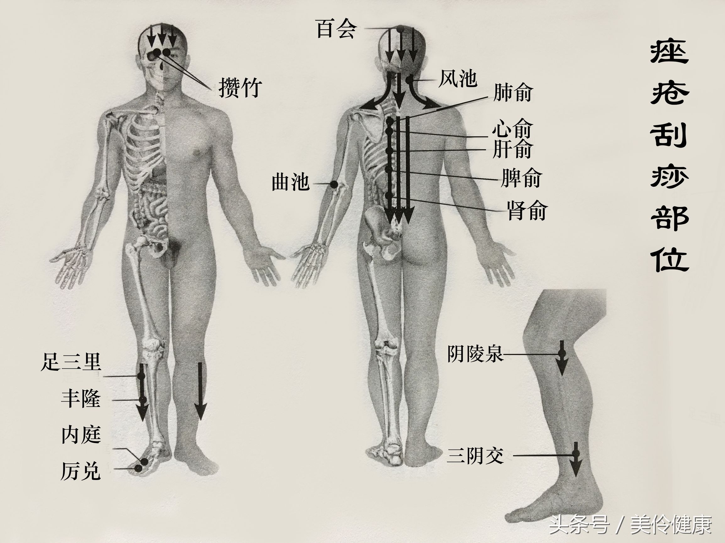 白癜风治疗的刮痧法,刮痧刺血治疗白癜风