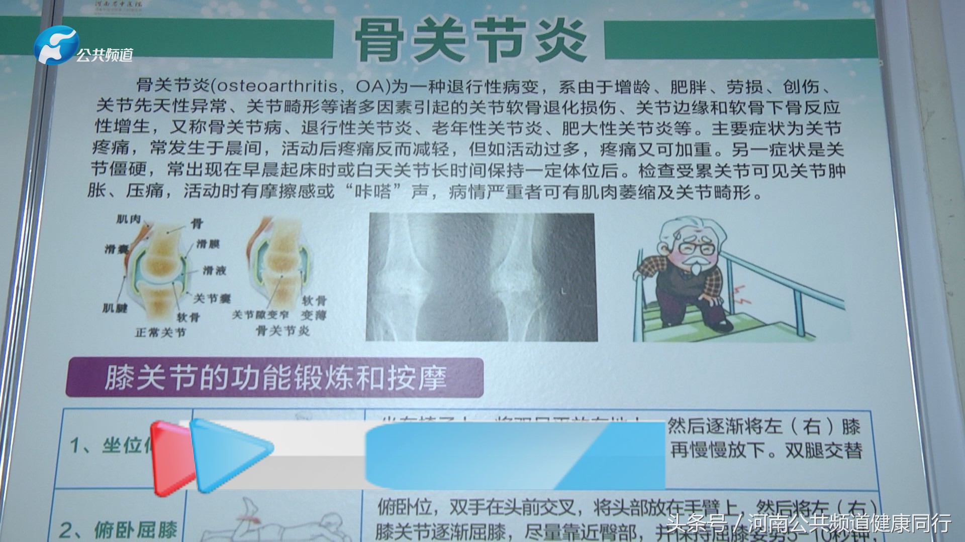 河南中医一附院类风湿专家一览表,风湿骨病患者采访