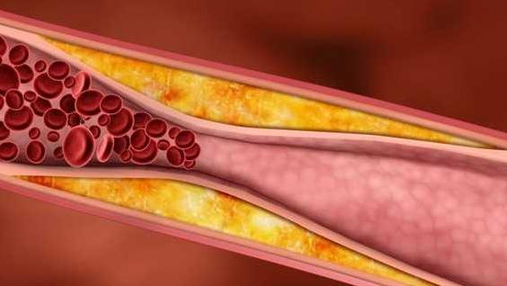 天冷了，需要带老人去输液通血管吗？