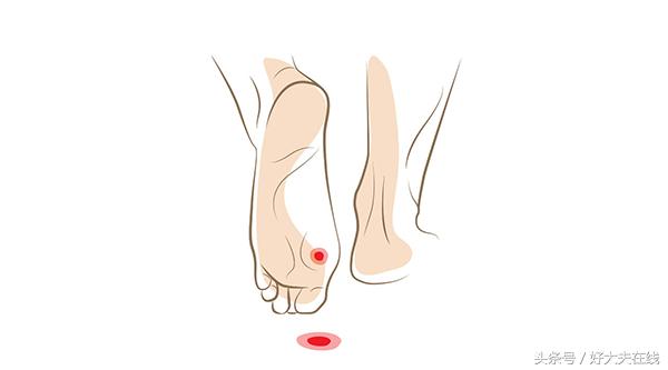 走路脚好疼该怎么安慰,走路多了脚疼跟鞋有关系吗