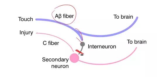 聚焦颈肩腰腿疼,中度疼痛的镇痛方法