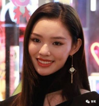 林允整牙却像整容？她是真的又整了啊！