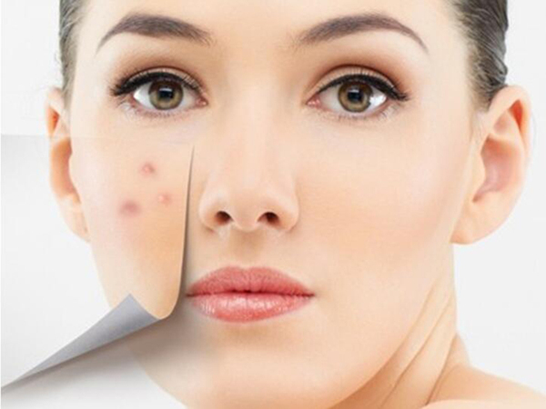 右脸长痘怎么快速有效的解决,婴儿右脸长痘痘是什么原因