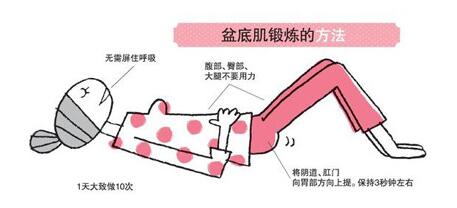为什么要做产后盆底康复,产后两年了盆底康复还管用吗