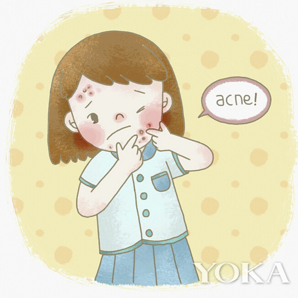 去闭口美容项目,美容护肤问题解答