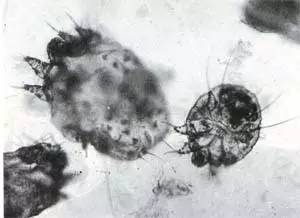 GET这14条，你就可以和疥疮拜拜了