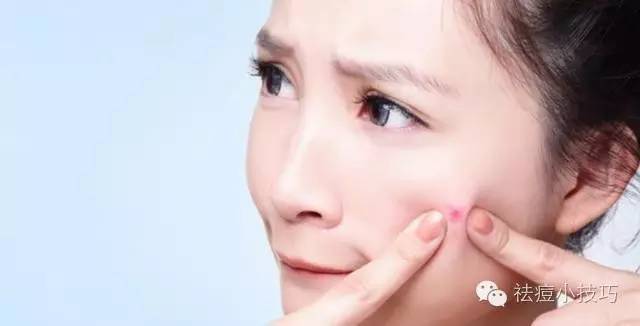 脸上各个部位长痘原因一张图,战豆豆