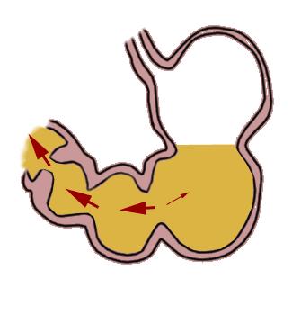 「健康」胃胀、胃酸很难受？专家助你打好健康保“胃”战！