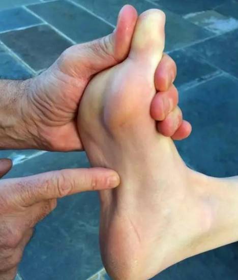 足底筋膜炎康复训练,脚筋膜炎运动康复训练