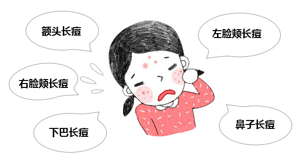 祛痘痘的药膏过敏怎么办,青春痘抹了药变红起皮还很疼