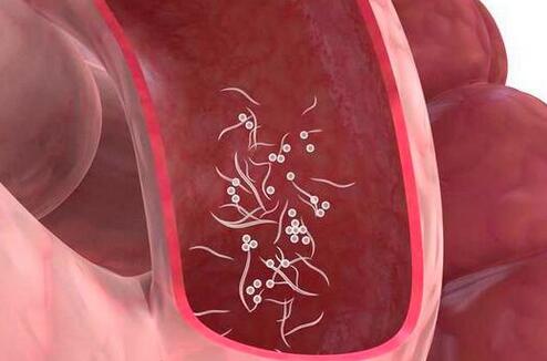 如何判断宝宝得了蛲虫病,7个月宝宝会感染蛲虫吗