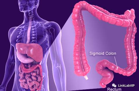 炎症性肠病治疗方案,炎症性肠病治疗方法