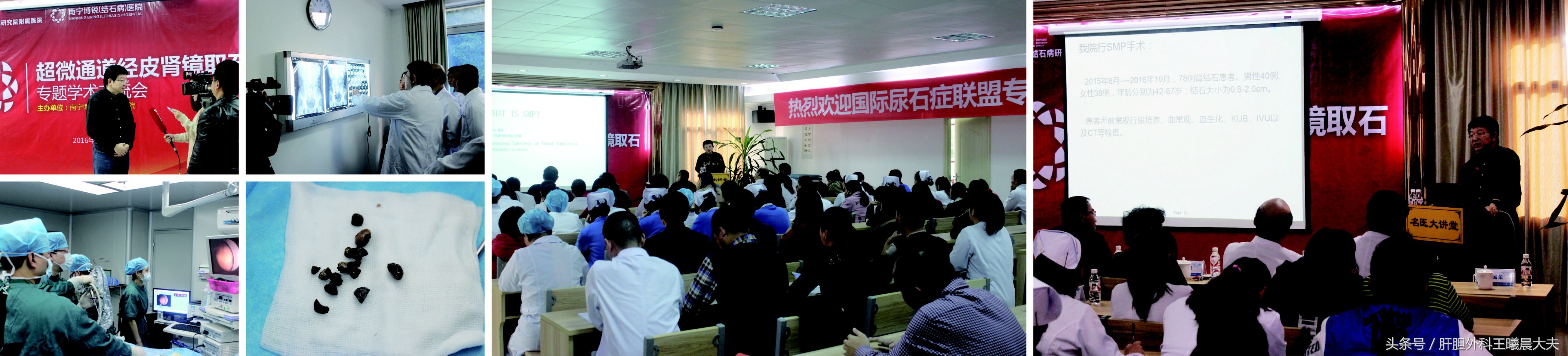 国际尿石症联盟专家莅临南宁博锐医院亲诊与学术沟通