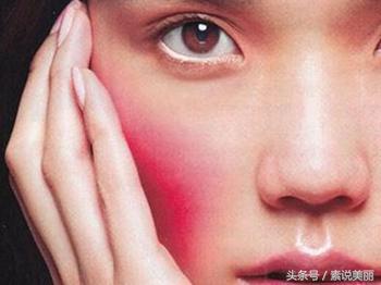 用了激素产品脸上有什么症状,脸上用了有激素的化妆品怎么恢复